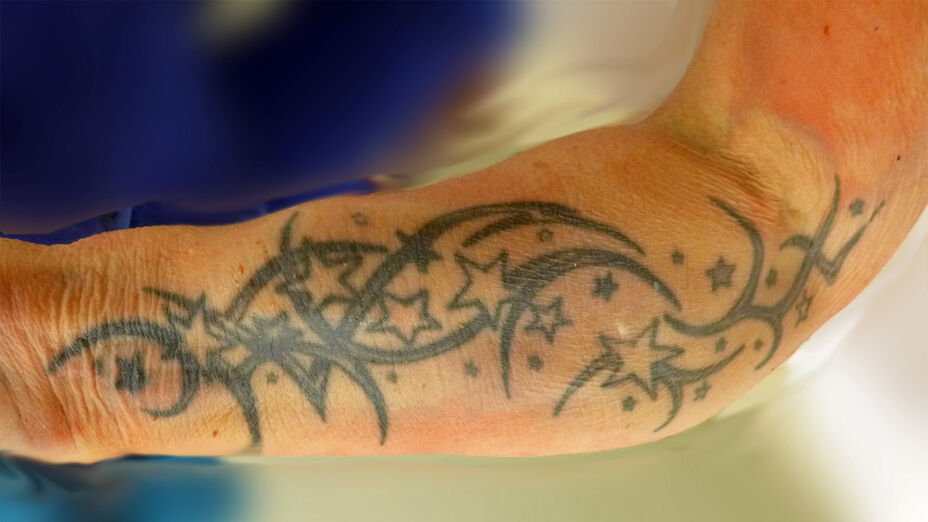 Tätowierung der unbekannten Toten; schwarze Tätowierung mit Wellen und Sternen in unterschiedlicher Größe auf dem Unterarm